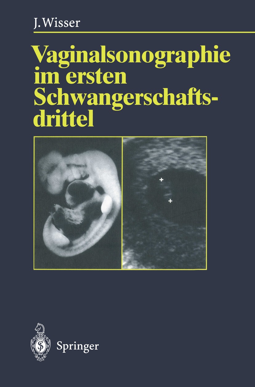 Titlebook: Vaginalsonographie im ersten Schwangerschaftsdrittel; Josef Wisser Book 1995 Springer-Verlag Berlin-Heidelberg 1995 1. Trimenon.Diagnostik Titlebook: Vaginalsonographie im ersten Schwangerschaftsdrittel; Josef Wisser Book 1995 Springer-Verlag Berlin-Heidelberg 1995 1. Trimenon.Diagnostik