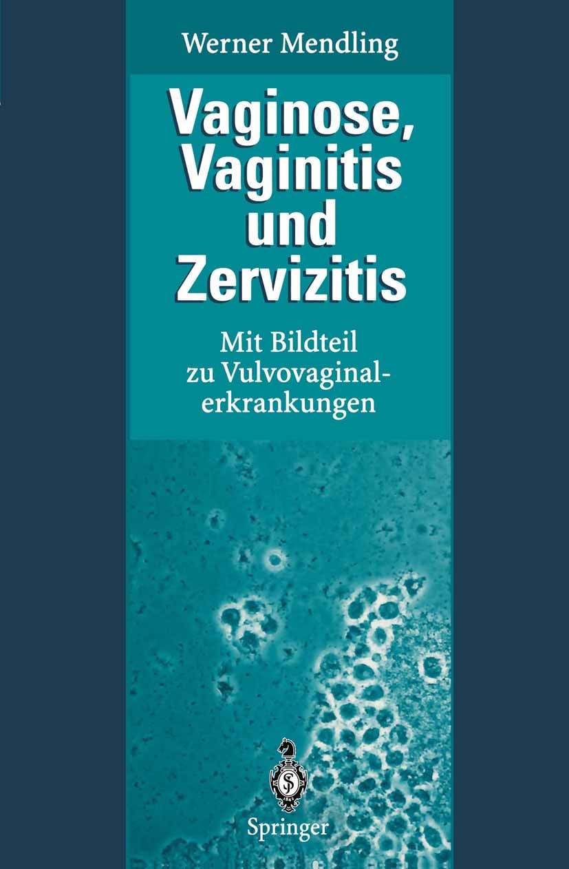 Titlebook: Vaginose, Vaginitis und Zervizitis; Mit Bildteil zu Vulv Werner Mendling Book 19951st edition Springer-Verlag Berlin Heidelberg 1995 Frauen Titlebook: Vaginose, Vaginitis und Zervizitis; Mit Bildteil zu Vulv Werner Mendling Book 19951st edition Springer-Verlag Berlin Heidelberg 1995 Frauen