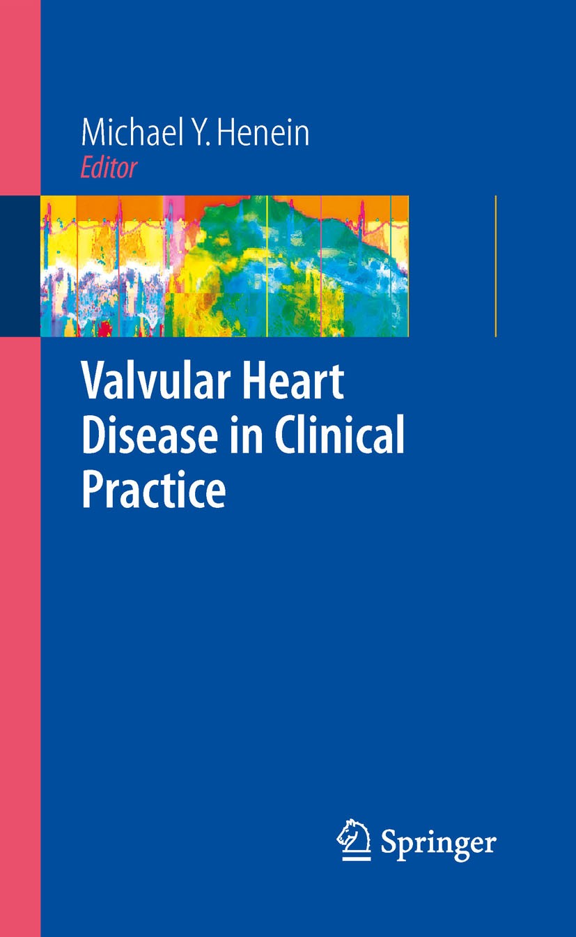 Titlebook: Valvular Heart Disease in Clinical Practice; Michael Y. Henein (Consultant Cardiologist) Book 2009 Springer-Verlag London 2009 Stress.anat Titlebook: Valvular Heart Disease in Clinical Practice; Michael Y. Henein (Consultant Cardiologist) Book 2009 Springer-Verlag London 2009 Stress.anat