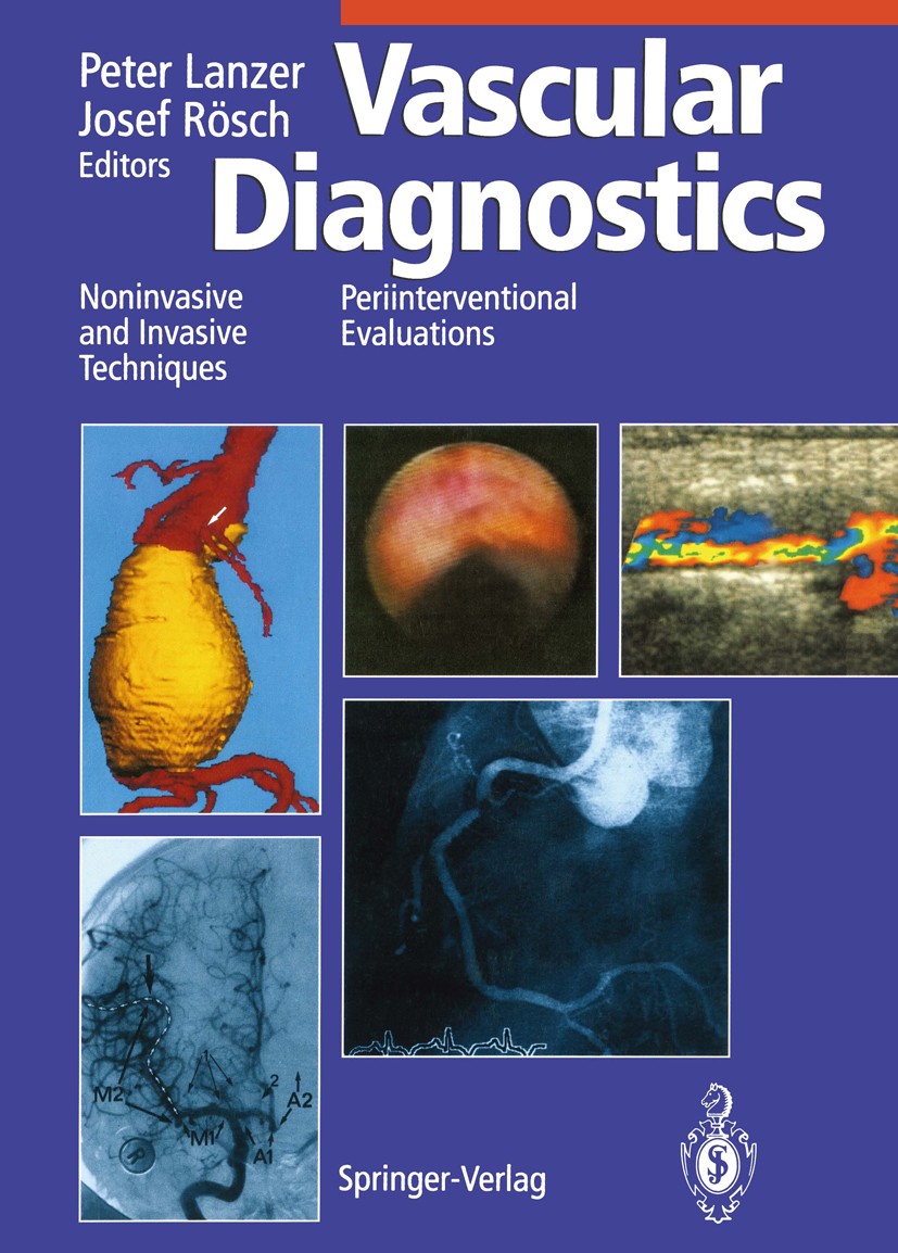 Titlebook: Vascular Diagnostics; Noninvasive and Inva Peter Lanzer,Josef Rösch Book 1994 Springer-Verlag Berlin Heidelberg 1994 Angiography.Coronary A Titlebook: Vascular Diagnostics; Noninvasive and Inva Peter Lanzer,Josef Rösch Book 1994 Springer-Verlag Berlin Heidelberg 1994 Angiography.Coronary A