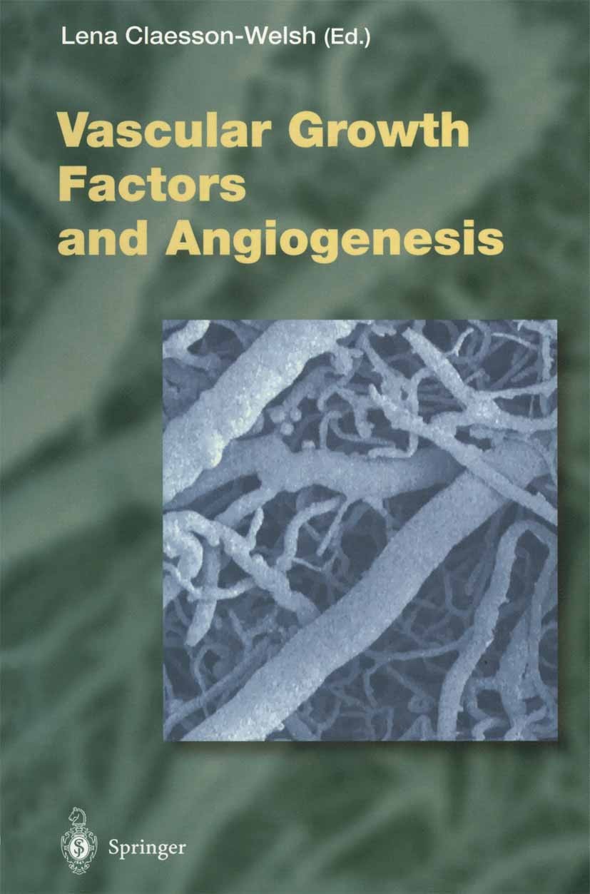 Titlebook: Vascular Growth Factors and Angiogenesis; Lena Claesson-Welsh Book 1999 The Editor(s) (if applicable) and The Author(s), under exclusive l Titlebook: Vascular Growth Factors and Angiogenesis; Lena Claesson-Welsh Book 1999 The Editor(s) (if applicable) and The Author(s), under exclusive l