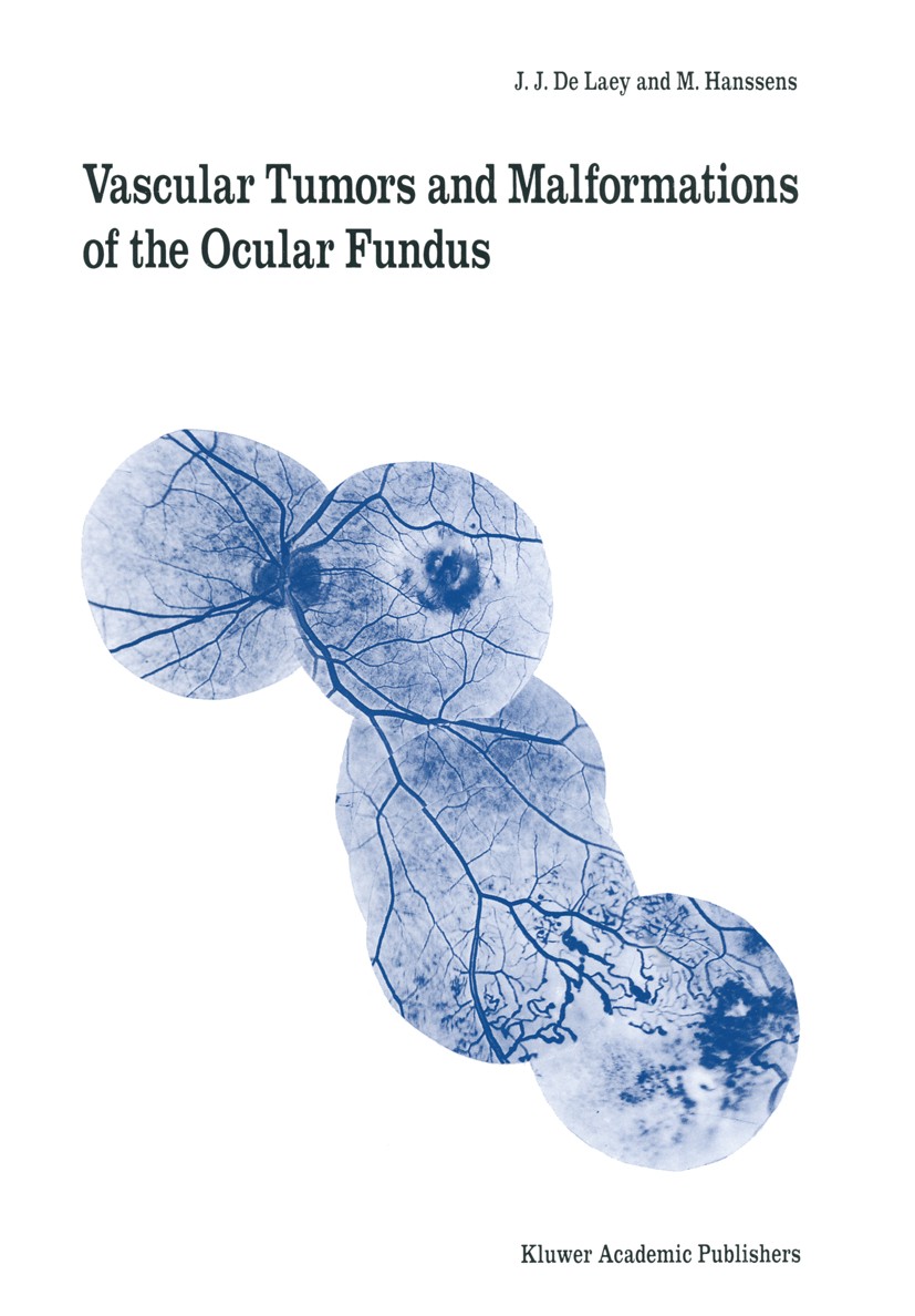 Titlebook: Vascular Tumors and Malformations of the Ocular Fundus; J. J. Laey,M. Hanssens Book 1990 Belgian Society of Ophthalmology, Leuven, Belgium Titlebook: Vascular Tumors and Malformations of the Ocular Fundus; J. J. Laey,M. Hanssens Book 1990 Belgian Society of Ophthalmology, Leuven, Belgium