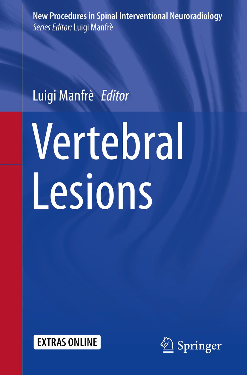 Titlebook: Vertebral Lesions; Luigi Manfrè Book 2017 Springer International Publishing AG 2017 Augmentation techniques.CT guidance.Cryoablation.Embol Titlebook: Vertebral Lesions; Luigi Manfrè Book 2017 Springer International Publishing AG 2017 Augmentation techniques.CT guidance.Cryoablation.Embol
