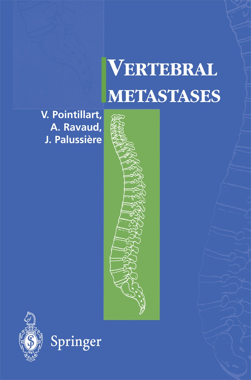 Titlebook: Vertebral metastases; Vincent Pointillart,Alain Ravaud,Jean Palussière Book 2002 Springer-Verlag Paris 2002 Rehabilitation.Tumor.chirurgy. Titlebook: Vertebral metastases; Vincent Pointillart,Alain Ravaud,Jean Palussière Book 2002 Springer-Verlag Paris 2002 Rehabilitation.Tumor.chirurgy.