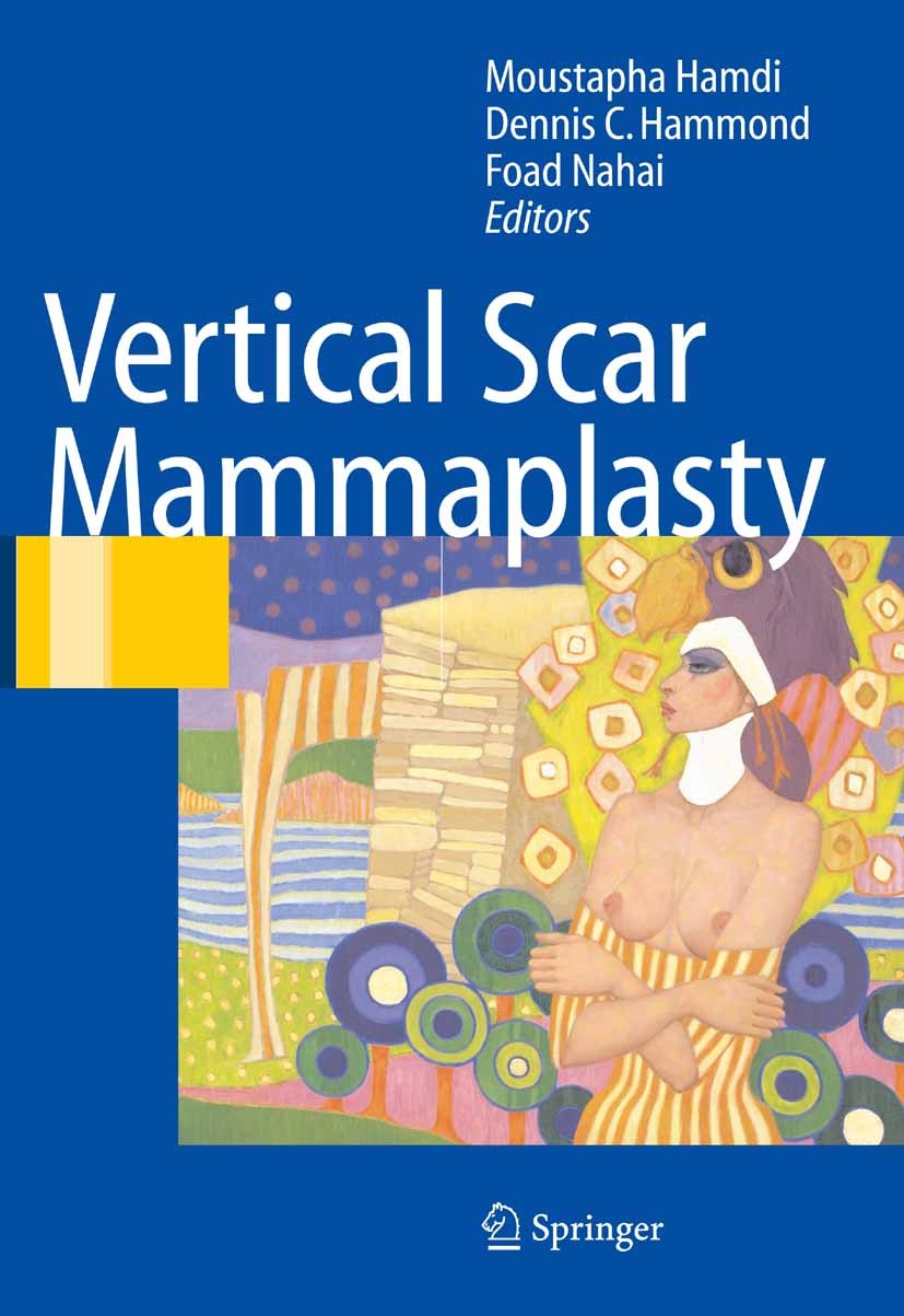 Titlebook: Vertical Scar Mammaplasty; Moustapha Hamdi,Dennis C. Hammond,Foad Nahai Book 20051st edition Springer-Verlag Berlin Heidelberg 2005 Breast Titlebook: Vertical Scar Mammaplasty; Moustapha Hamdi,Dennis C. Hammond,Foad Nahai Book 20051st edition Springer-Verlag Berlin Heidelberg 2005 Breast