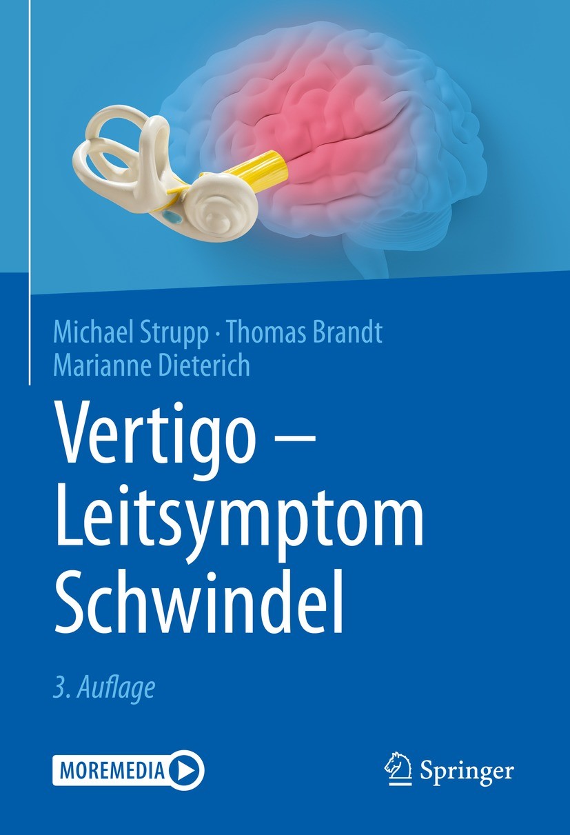 Titlebook: Vertigo - Leitsymptom Schwindel; Michael Strupp,Thomas Brandt,Marianne Dieterich Book 2022Latest edition Springer-Verlag GmbH Deutschland, Titlebook: Vertigo - Leitsymptom Schwindel; Michael Strupp,Thomas Brandt,Marianne Dieterich Book 2022Latest edition Springer-Verlag GmbH Deutschland,