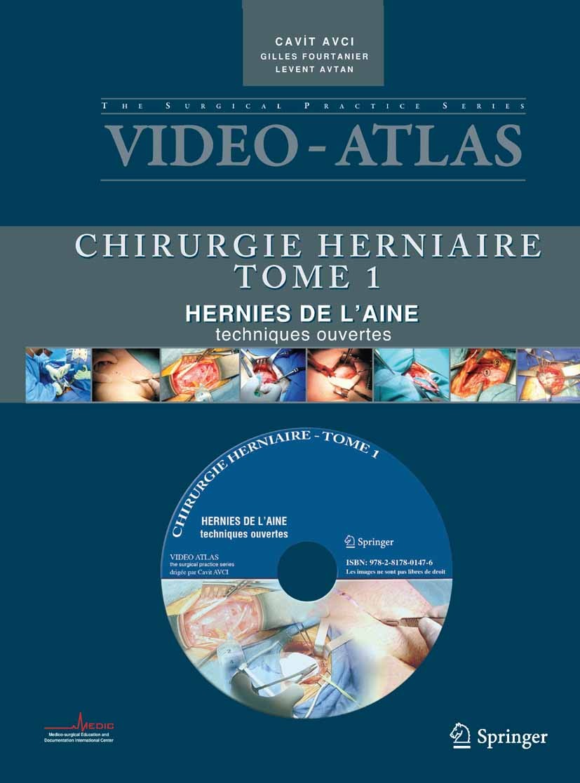 Titlebook: Vidéo atlas Chirurgie herniaire; I. Hernie de l’aine, Cavit Avci,Gilles Fourtanier,Levent Avtan Book 2010Latest edition Springer-Verlag Fra Titlebook: Vidéo atlas Chirurgie herniaire; I. Hernie de l’aine, Cavit Avci,Gilles Fourtanier,Levent Avtan Book 2010Latest edition Springer-Verlag Fra