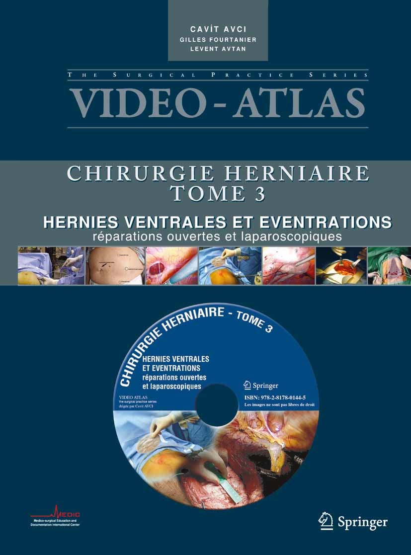 Titlebook: Vidéo-Atlas Chirurgie herniaire; III. Hernies ventral Cavit Avci,Gilles Fourtanier,Levent Avtan Book 2011Latest edition Springer-Verlag Fra Titlebook: Vidéo-Atlas Chirurgie herniaire; III. Hernies ventral Cavit Avci,Gilles Fourtanier,Levent Avtan Book 2011Latest edition Springer-Verlag Fra