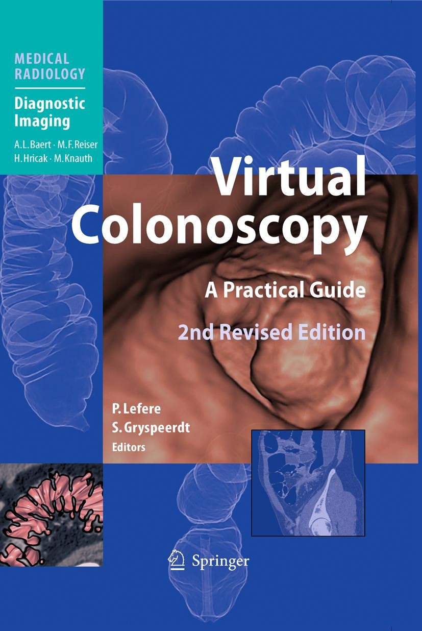 Titlebook: Virtual Colonoscopy; A Practical Guide P. Lefere,S. Gryspeerdt Book 2010Latest edition The Editor(s) (if applicable) and The Author(s), und Titlebook: Virtual Colonoscopy; A Practical Guide P. Lefere,S. Gryspeerdt Book 2010Latest edition The Editor(s) (if applicable) and The Author(s), und