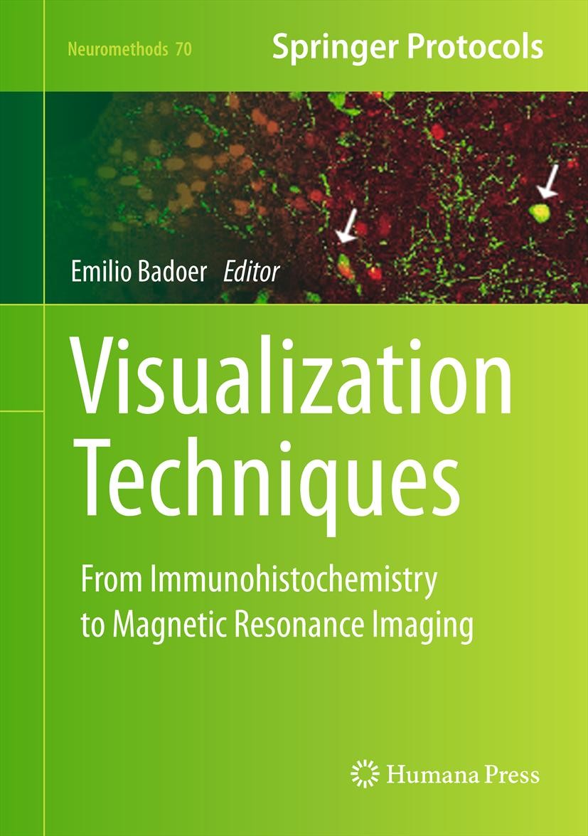 Titlebook: Visualization Techniques; From Immunohistochem Emilio Badoer Book 2012 Springer Science+Business Media, LLC 2012 Immunofluorescence.Immunoh Titlebook: Visualization Techniques; From Immunohistochem Emilio Badoer Book 2012 Springer Science+Business Media, LLC 2012 Immunofluorescence.Immunoh