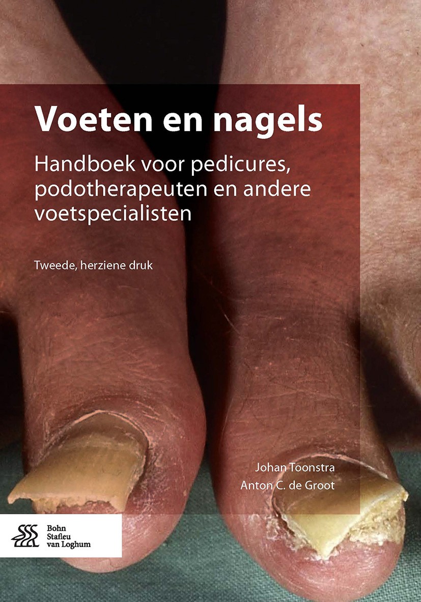 Titlebook: Voeten en nagels; Handboek voor pedicu Johan Toonstra,Anton C. de Groot Book 2017Latest edition Bohn Stafleu van Loghum 2017 nagelaandoenin Titlebook: Voeten en nagels; Handboek voor pedicu Johan Toonstra,Anton C. de Groot Book 2017Latest edition Bohn Stafleu van Loghum 2017 nagelaandoenin