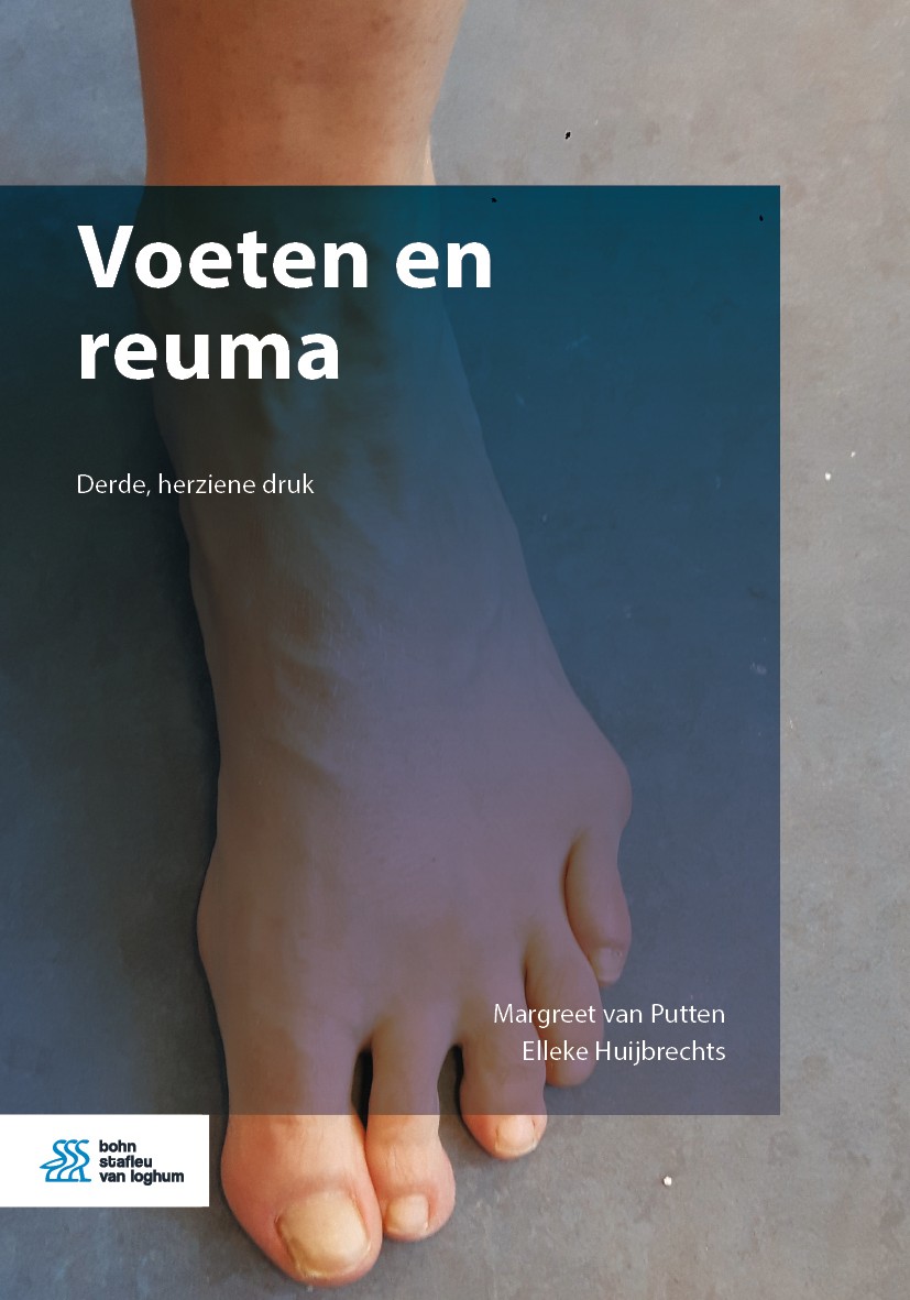 Titlebook: Voeten en reuma; Margreet van Putten,Elleke Huijbrechts Book 2020Latest edition Bohn Stafleu van Loghum is een imprint van Springer Media Titlebook: Voeten en reuma; Margreet van Putten,Elleke Huijbrechts Book 2020Latest edition Bohn Stafleu van Loghum is een imprint van Springer Media