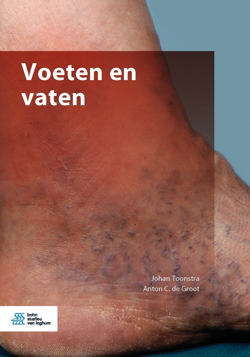 Titlebook: Voeten en vaten; Johan Toonstra,Anton C. de Groot Book 2020Latest edition Bohn Stafleu van Loghum is een imprint van Springer Media B.V., Titlebook: Voeten en vaten; Johan Toonstra,Anton C. de Groot Book 2020Latest edition Bohn Stafleu van Loghum is een imprint van Springer Media B.V.,