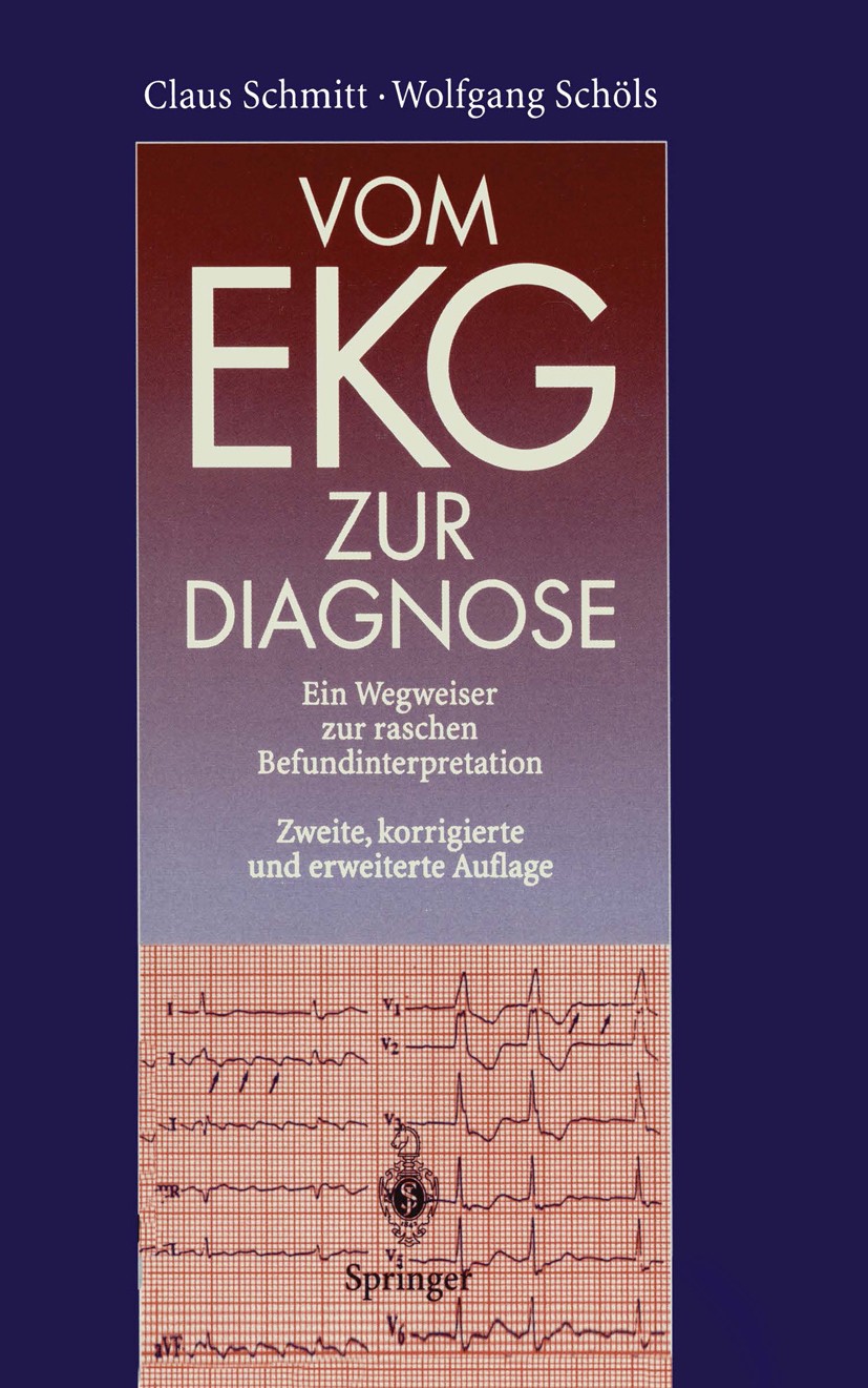 Titlebook: Vom EKG zur Diagnose; Ein Wegweiser zur ra Claus Schmitt,Wolfgang Schöls Book 19952nd edition Springer-Verlag Berlin Heidelberg 1995 AV-Blo Titlebook: Vom EKG zur Diagnose; Ein Wegweiser zur ra Claus Schmitt,Wolfgang Schöls Book 19952nd edition Springer-Verlag Berlin Heidelberg 1995 AV-Blo