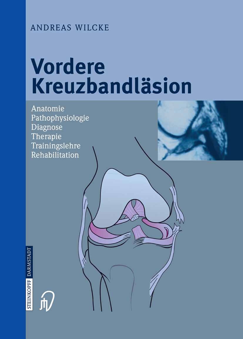 Titlebook: Vordere Kreuzbandläsion; Anatomie Pathophysio Andreas Wilcke Book 2004 Springer-Verlag Berlin Heidelberg 2004 Arthrose.Biomechanik.Instabil Titlebook: Vordere Kreuzbandläsion; Anatomie Pathophysio Andreas Wilcke Book 2004 Springer-Verlag Berlin Heidelberg 2004 Arthrose.Biomechanik.Instabil