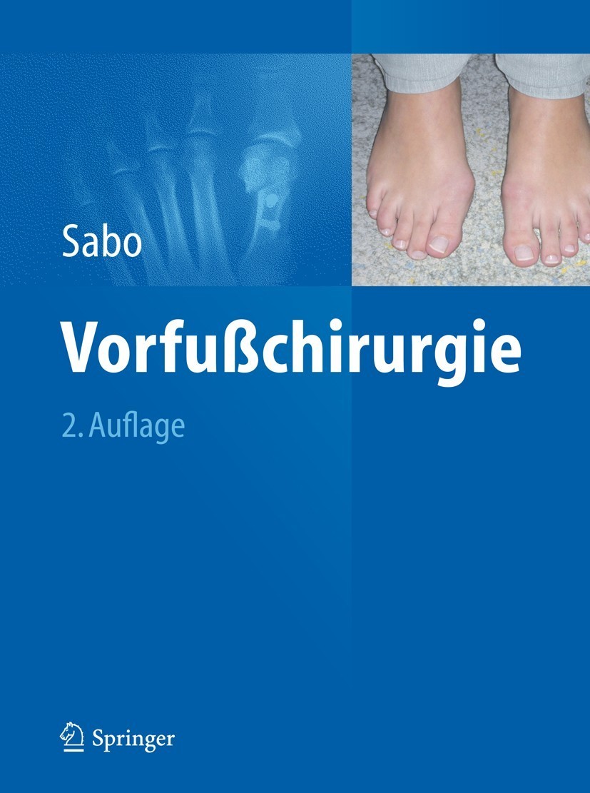 Titlebook: Vorfußchirurgie; Desiderius Sabo Book 2012Latest edition Springer-Verlag Berlin Heidelberg 2012 Trauma Surgery Titlebook: Vorfußchirurgie; Desiderius Sabo Book 2012Latest edition Springer-Verlag Berlin Heidelberg 2012 Trauma Surgery
