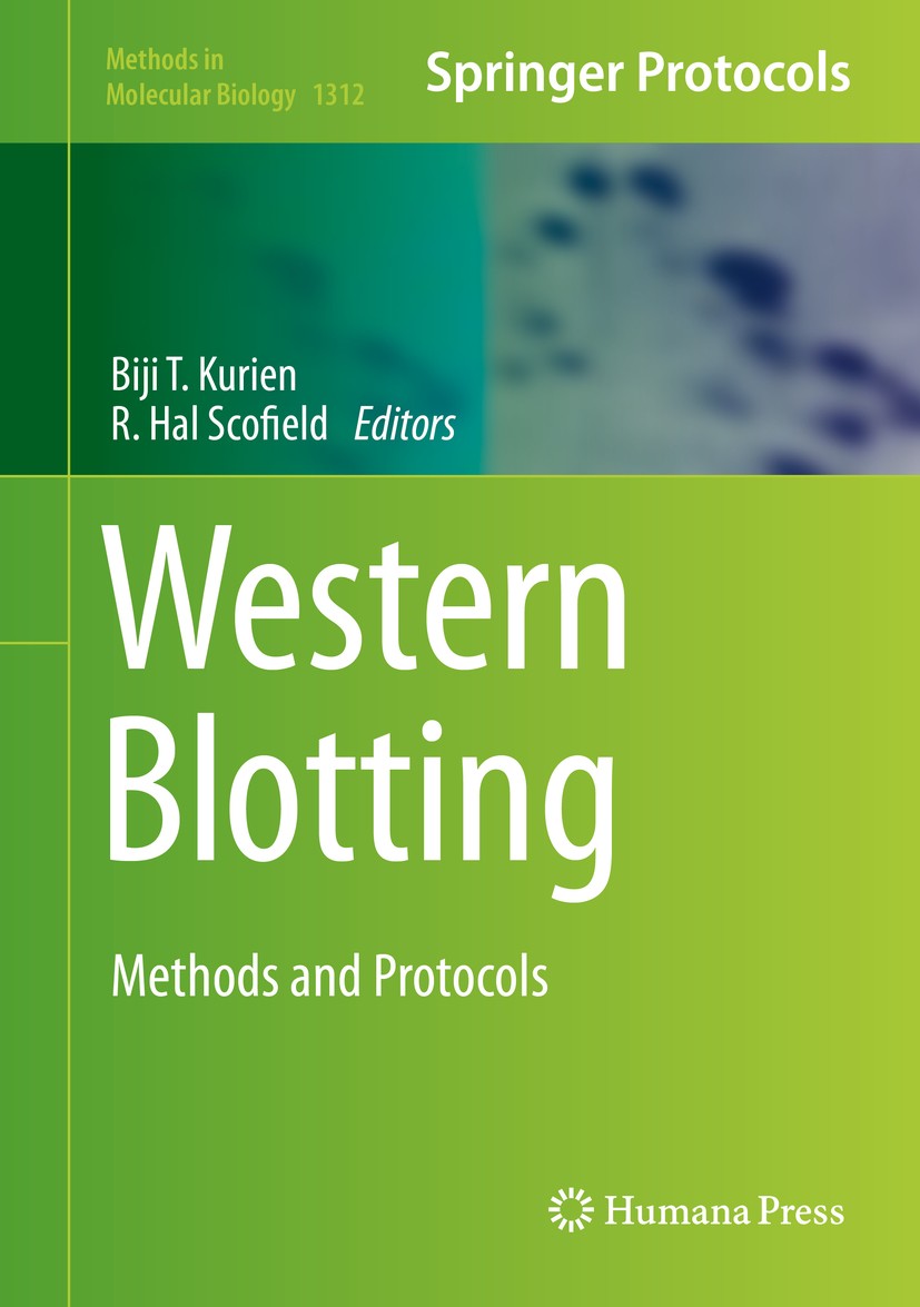 Titlebook: Western Blotting; Methods and Protocol Biji T. Kurien,R. Hal Scofield Book 2015 Springer Science+Business Media New York 2015 Antigenic Pep Titlebook: Western Blotting; Methods and Protocol Biji T. Kurien,R. Hal Scofield Book 2015 Springer Science+Business Media New York 2015 Antigenic Pep