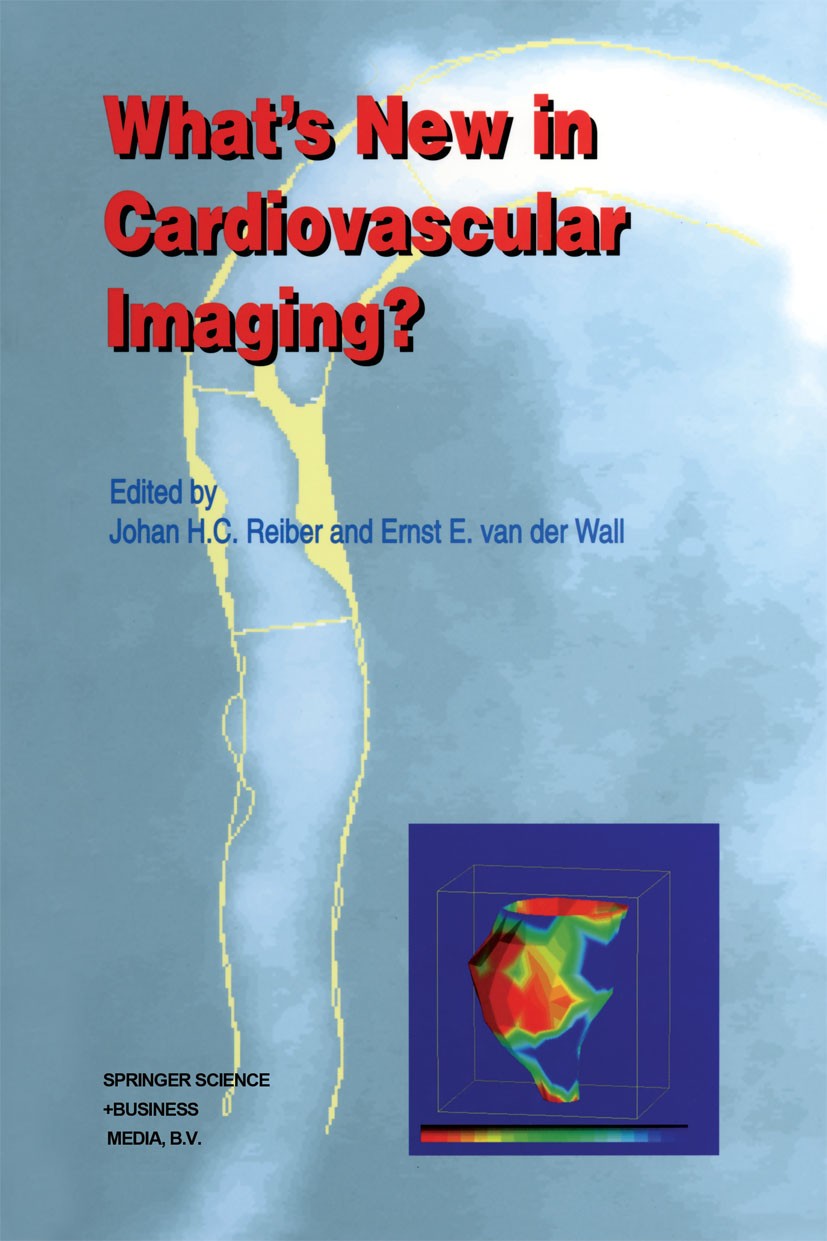 Titlebook: What’s New in Cardiovascular Imaging?; Johan H. C. Reiber,Ernst E. Wall Book 1998 Springer Science+Business Media Dordrecht 1998 cardiolog Titlebook: What’s New in Cardiovascular Imaging?; Johan H. C. Reiber,Ernst E. Wall Book 1998 Springer Science+Business Media Dordrecht 1998 cardiolog