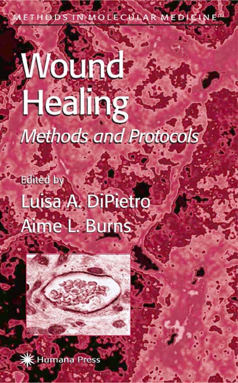 Titlebook: Wound Healing; Methods and Protocol Luisa A. DiPietro,Aime L. Burns Book 2003 Humana Press 2003 Titlebook: Wound Healing; Methods and Protocol Luisa A. DiPietro,Aime L. Burns Book 2003 Humana Press 2003