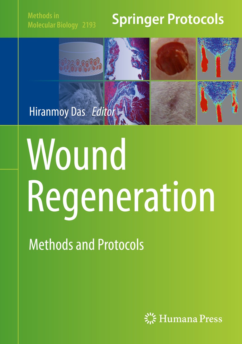 Titlebook: Wound Regeneration; Methods and Protocol Hiranmoy Das Book 2021 Springer Science+Business Media, LLC, part of Springer Nature 2021 Tissue r Titlebook: Wound Regeneration; Methods and Protocol Hiranmoy Das Book 2021 Springer Science+Business Media, LLC, part of Springer Nature 2021 Tissue r