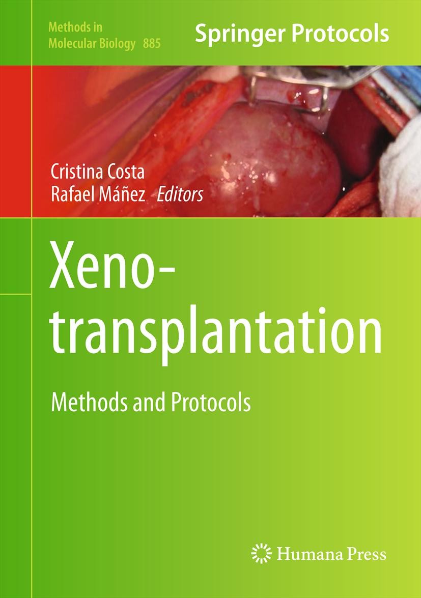 Titlebook: Xenotransplantation; Methods and Protocol Cristina Costa,Rafael Máñez Book 2012 Springer Science+Business Media, LLC 2012 Xenogeneic cells. Titlebook: Xenotransplantation; Methods and Protocol Cristina Costa,Rafael Máñez Book 2012 Springer Science+Business Media, LLC 2012 Xenogeneic cells.