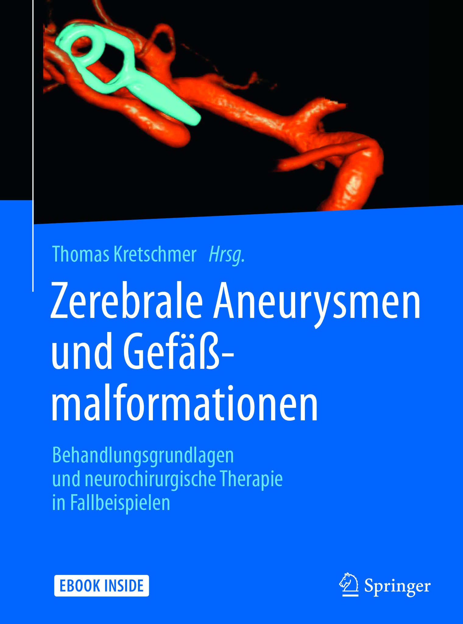 Titlebook: Zerebrale Aneurysmen und Gefäßmalformationen; Behandlungsgrundlage Thomas Kretschmer Book 2017 Springer-Verlag GmbH Deutschland 2017 Gehirn Titlebook: Zerebrale Aneurysmen und Gefäßmalformationen; Behandlungsgrundlage Thomas Kretschmer Book 2017 Springer-Verlag GmbH Deutschland 2017 Gehirn